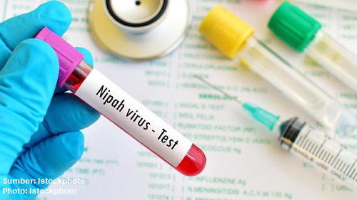 Dinkes Sumatera Utara Perketat Pengawasan Pintu Kedatangan Internasional Untuk Cegah Persebaran Virus Nipah